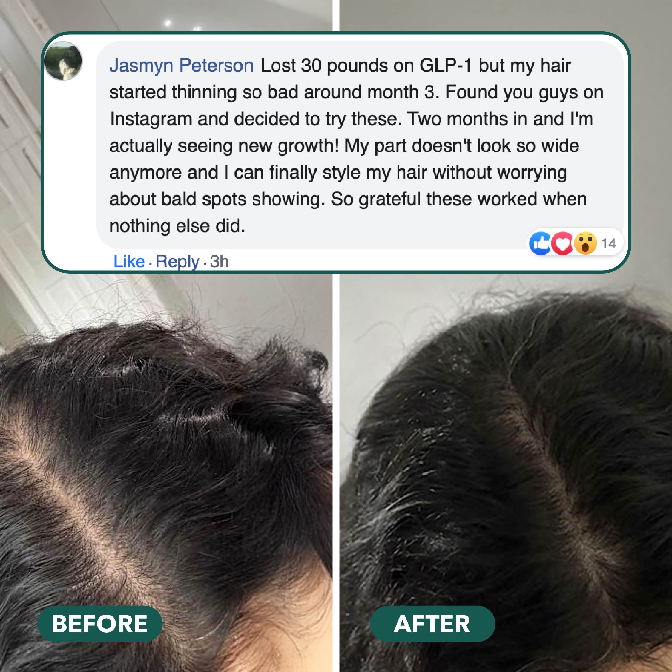 Hair Revive Gummies